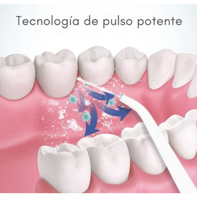 Irrigador Bucal Portátil Limpieza Dental